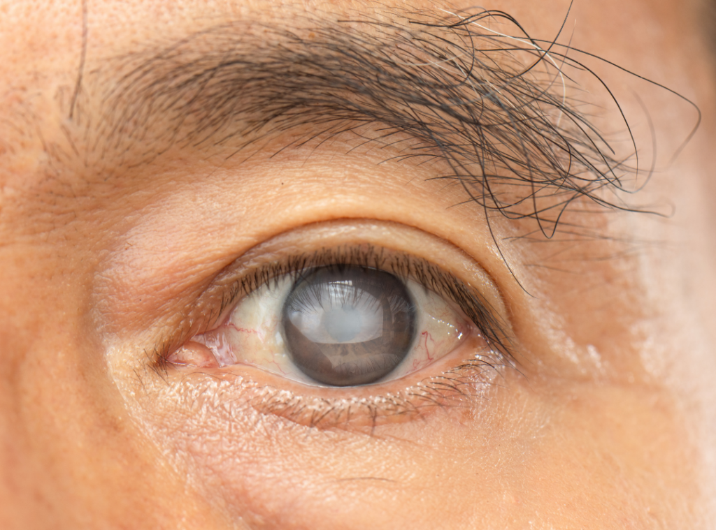 common eye problems in older adults