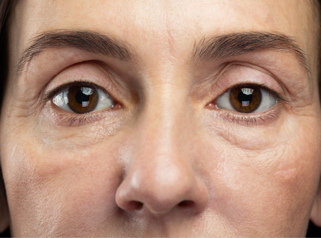 decrease visual acuity